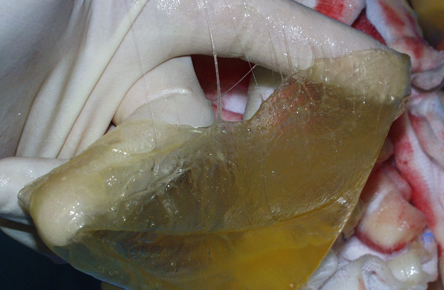 Implantat_01